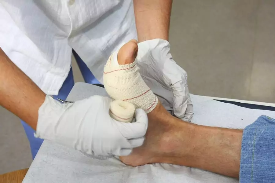 The Basic Of Treating Infected Wounds