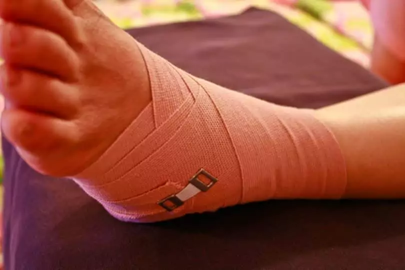 a bandaged ankle of a woman