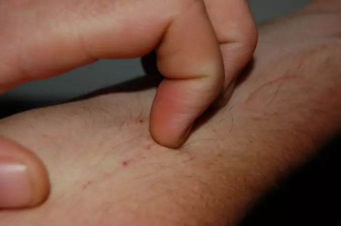 A person scratching their hand